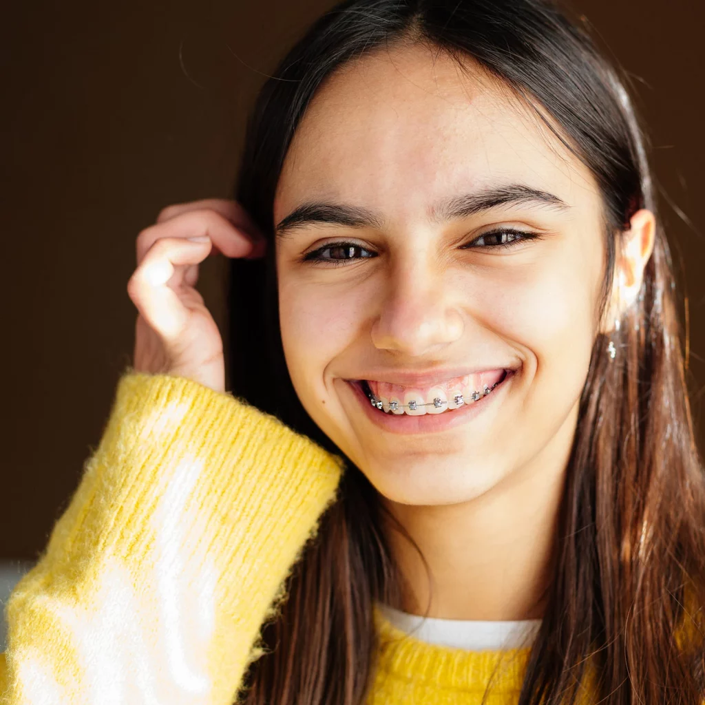 Traditional Dental Braces 1 svg+xml;charset=utf